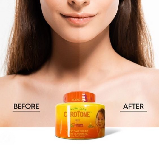 Crema Aclarante Carotone 135ml - Ilumina, Hidrata y Unifica el Tono de la Piel